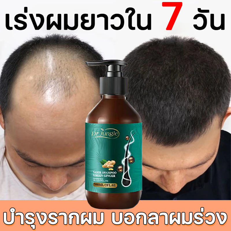 🌸ของแท้🍀 Dr Jungle แชมพูปลูกผม แชมพูขิง ป้องกันผมร่วง ป้องกันผมบาง บำรุงรากผม บอกลาผมร่วง ขนาด 500ml