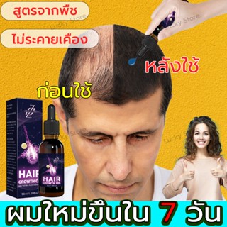 [เร็ว ผม การเจริญเติบโต] เซรั่มปลูกผม น้ํายาปลูกผมแบบหนา น้ํ…