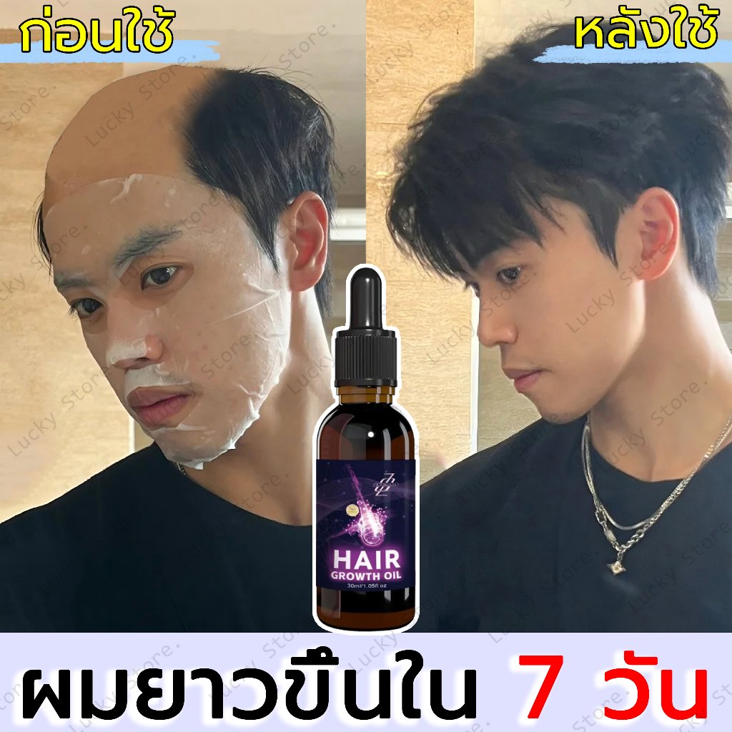 【ปลูกผมเร็ว】เซรั่มปลูกผม น้ำยาปลูกผมดก น้ำยาเร่งผมยาว ยาปลูกผมของแท้ น้ำยาปลูกผมผู้ชาย ป้องกันผมร่วง ทำให้รากผมแข็งแรงมา