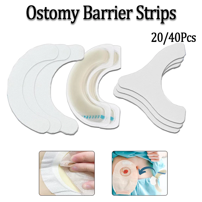 20/40PCS เทปไวต่อแรงกดยืดหยุ่น Ostomy Barrier Strips เกรดทางการแพทย์ Hydrocolloid Ostomy Care