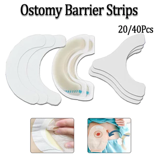 20/40PCS เทปไวต่อแรงกดยืดหยุ่น Ostomy Barrier Strips เกรดทางการแพทย์ Hydrocolloid Ostomy Care