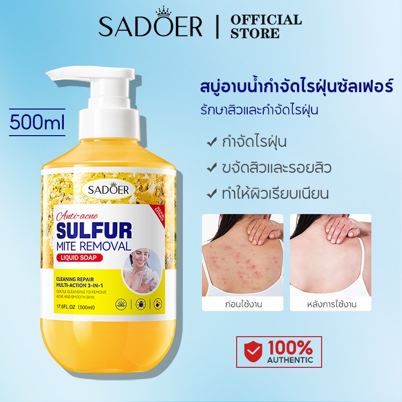 SADOER Acne Clear Anti-Mite Sulfur Bath Gel ซัลเฟอร์ ครีมอาบน้ำ กำจัดไรฝุ่น ปรับปรุงผิวคัน อ่อนโยน 500ML