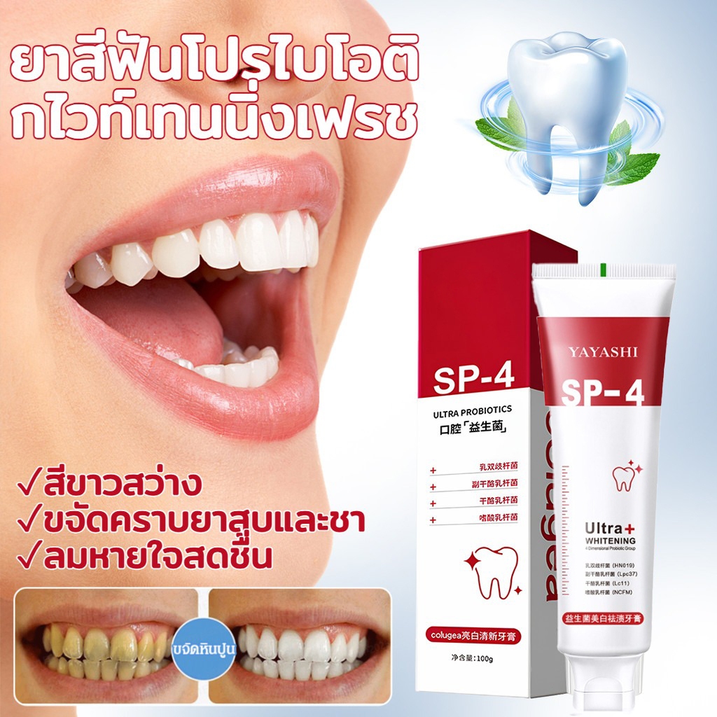 SP4 ยาสีฟันไวท์เทนนิ่ง โปรไบโอติก ลดคราบพลัค กลิ่นปากแรง ป้องกันฟันผุ ฟันขาวลมหายใจสดชื่น