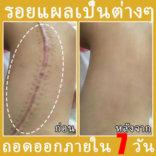 เจลลบรอยแผลเป็นสิว เจลลบรอยแผลเป็น ครีมลบรอยแผลเป็น เจลลบรอย…