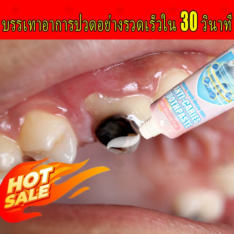 [ไม่มีฟันผุตลอดชีวิต] ยาสีฟันฟื้นฟูเหงือกอย่างรวดเร็วเพื่อบรรเทาอาการเสียวฟัน ฟันผุ บรรเทาความเสียหายของฟัน ทำความสะอาดล้ำลึก ปกป้องฟัน ทำให้ลมหายใจสดชื่น