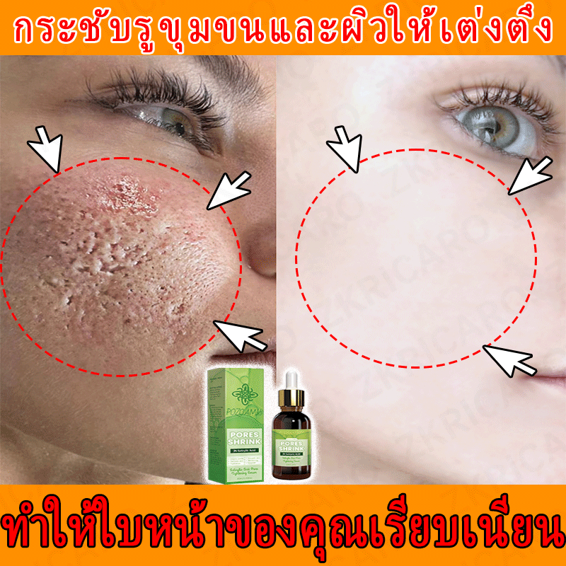 เซรั่มกระชับรูขุมขนจากเกาหลีใต้ ช่วยลดรอยสิว/สิวหัวดำ สำหรับผิวแพ้ง่าย
