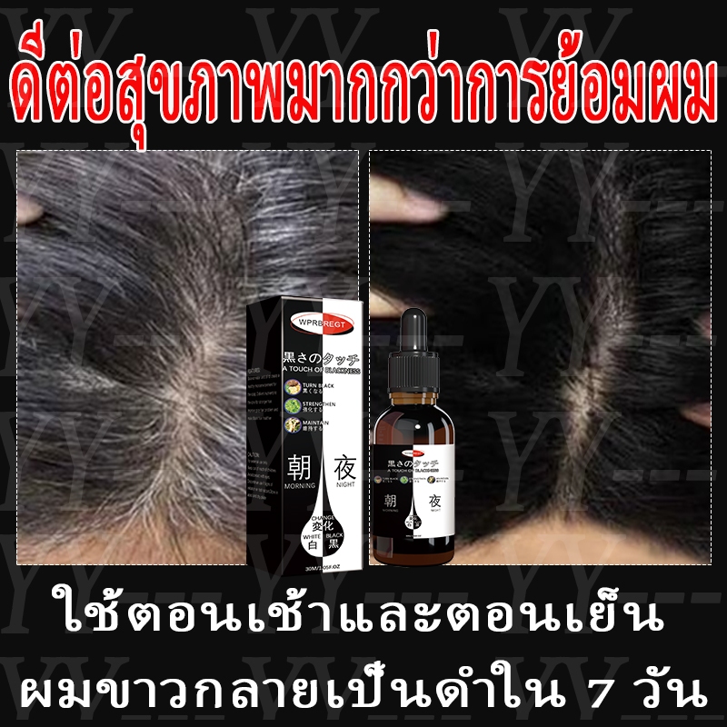 บอกลาผมหงอก ลดผมหงอก ปิดหงอก ผมดํา ซ่อมแซม เอสเซ้นส์บํารุงผม เปลี่ยนผมหงอกให้เป็นผมดํา ส่งเสริมการเจริญเติบโตของเส้นผม ผมดกดําหนาและป้องกั
