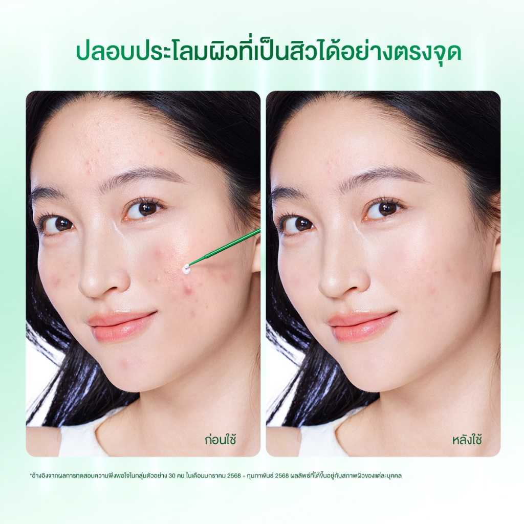 【NEW LUANCH】SKINTIFIC Acne Drying Lotion ช่วยทำให้สิวแห้งยุบเร็ว Salicylic Acid และ Betaine ลดโอกาสการเกิดสิวใหม่ - รูปที่ 3