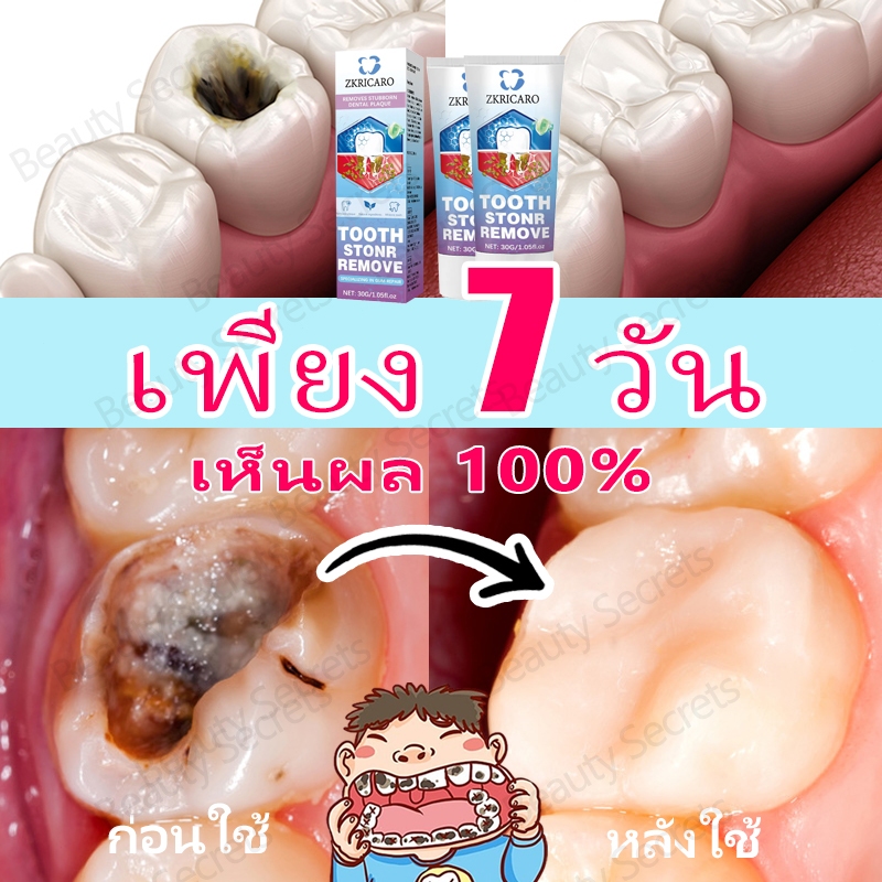 ยาสีฟันป้องกันฟันผุฟลูออไรด์ญี่ปุ่นซ่อมแซมเคลือบฟันซ่อมแซมโพรงป้องกันความไวกําจัดคราบพลัคและส่งเสริมการช่องปากที่มีสุขภาพดี