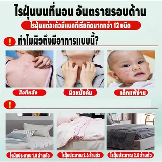 ขวดใหญ่ 500ML สเปรย์กำจัดไรฝุ่น ป้องกันไรฝุ่น ตัวเรือด ผลิตภัณฑ์กำจัดไรฝุ่น สำหรับผิวแพ้ง่าย