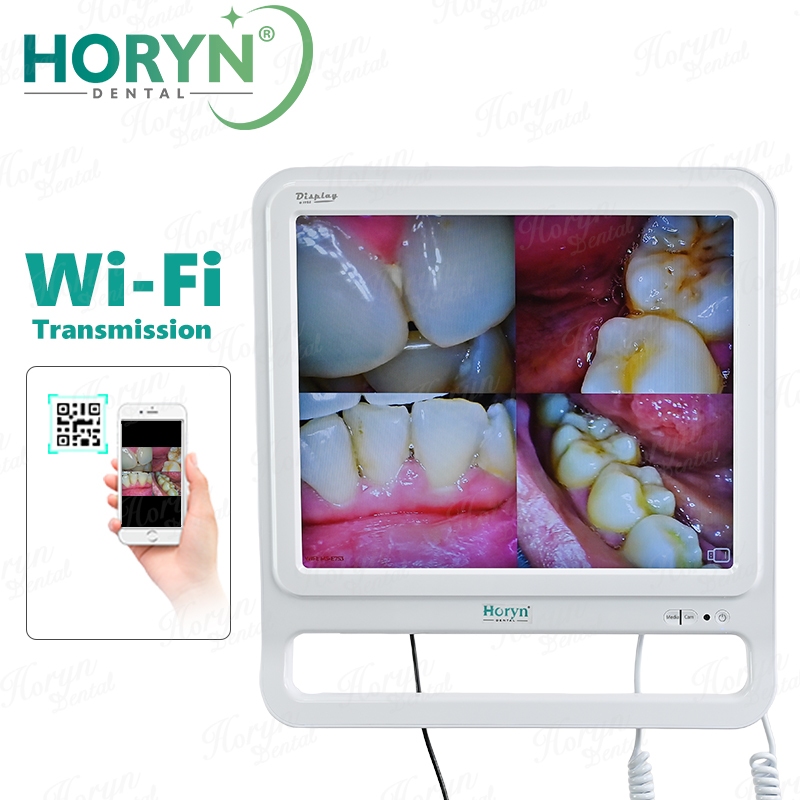 กล้องเอนโดสโคปทันตกรรมช่องปาก 8 LED Wifi HD พิกเซลความละเอียดสูง Intraoral 17 นิ้วจอภาพ LCD ดิจิตอล