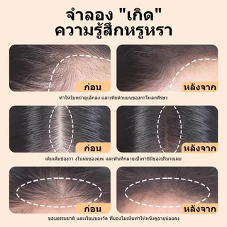 LEWEDOปกปิดหัวล้าน แป้งเงาผม ผงแฮร์ไลน์ แป้งฝุ่นปิดหัวเถิก หัวเหม่ง หัวล้าน ที่ปิดเหม่ง ผมบาง ผมล้าน