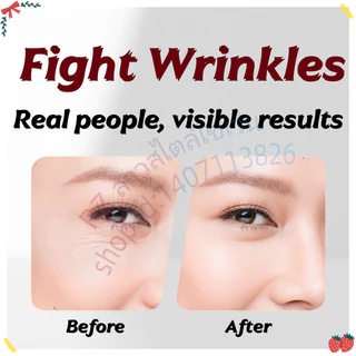 แผ่นแปะหน้าผากวิเศษ - Physical Beauty Glabellar Line Patch Anti-Wrinkle Trio Set