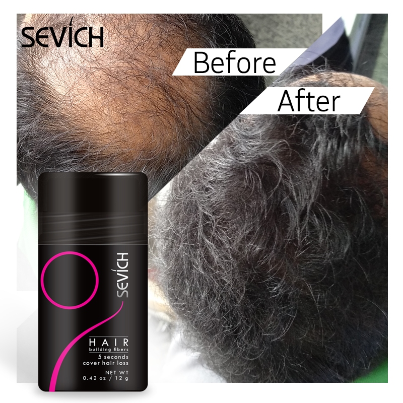 SEVICH ผงไฟเบอร์สร้างผมร่วง 12 กรัม Hair Fiber Refill Hair Building Hair Loss Treatment Powder