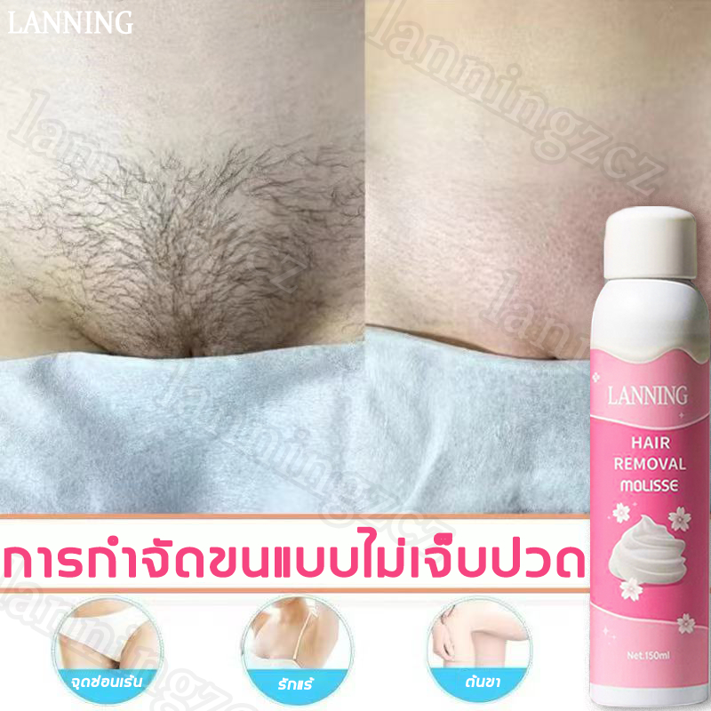 🔥ของแท้🔥 LANNING มูสกำจัดขน 150 ml สำหรับการกำจัดขนใต้วงแขน กำจัดขนด่วน กำจัดขนทั่วเรือนร่าง โฟมเนื้อละเอียด กำจัดขนอย่างอ่อนโยน (กำจัดขนถึงราก ไม่ทิ้งจุดด่างดำ ทุกเพศ กำจัดขนสะอาด กำจัดขนอย่างอ่อนโยน)