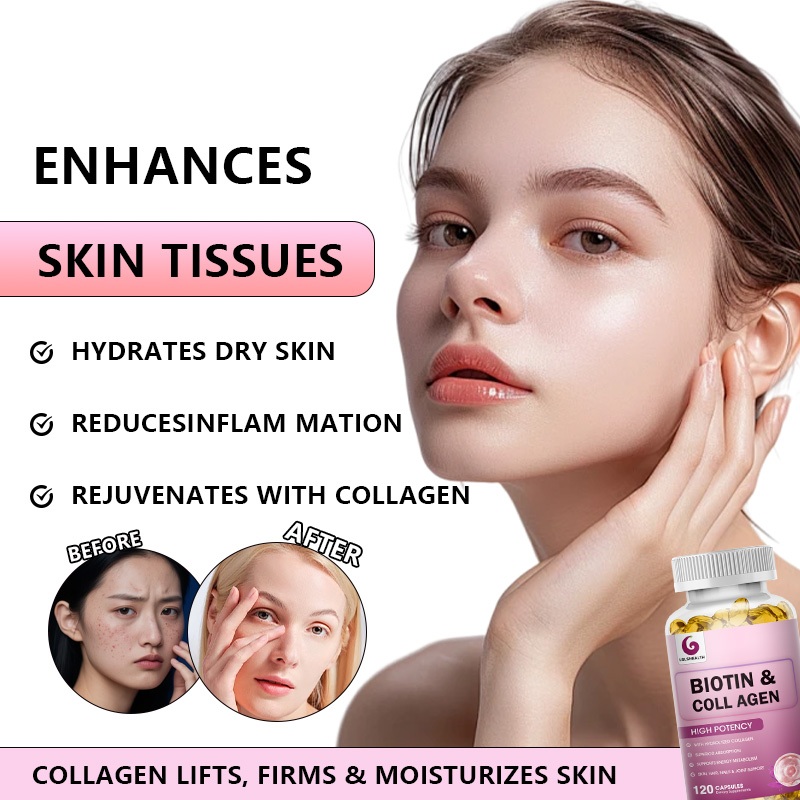 Collagen Biotin-40000mcg Skin Vitamin Biotin Collagen Biotin Collagen Capsules รักษาผมแห้ง เร่งการเจริญเติบโตของเส้นผม - รูปที่ 3