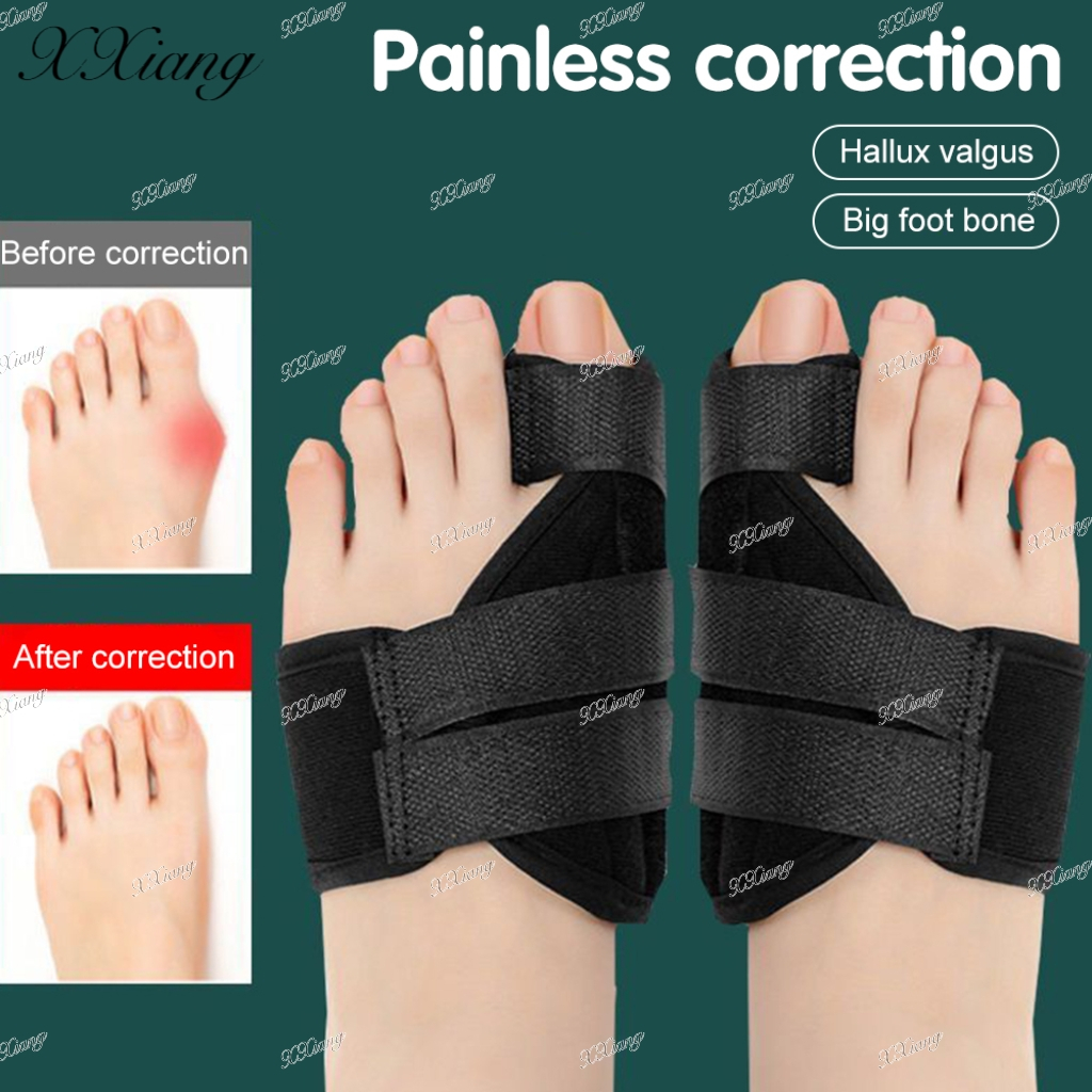 อุปกรณ์ที่รัดนิ้วเท้า Toe Correcter T1 ดามนิ้วเท้าคด hallux valgus นิ้วโป้งเท้าเก นิ้วโป้งเท้าไม่ตรง