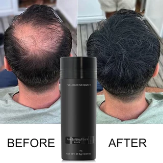 [🇹🇭⚡12hจัดส่ง] 4PCS Toppik Hair Fibers สเปรย์หนาผม Building Fibers Loss ผลิตภัณฑ์ทันทีวิกผม Regrowth ผง