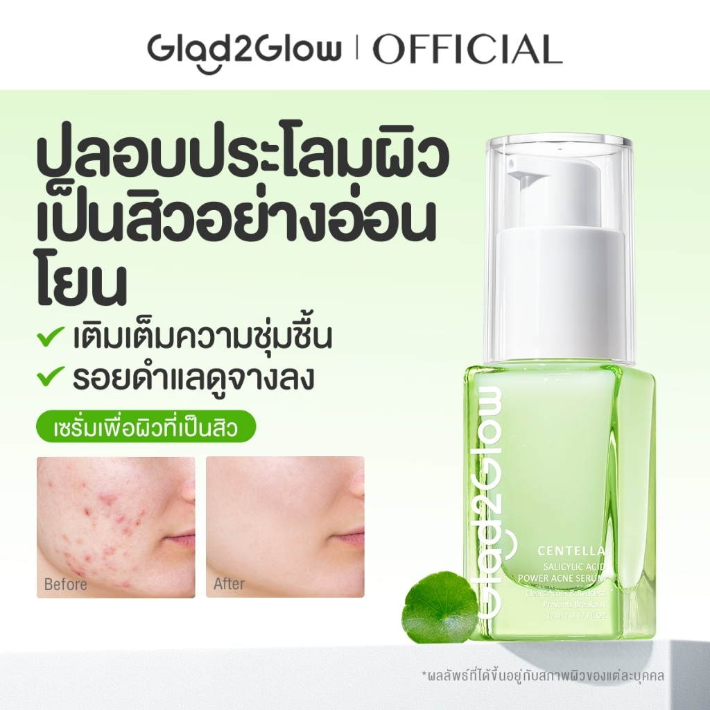 Glad2Glow Blemish Control Serum พร้อม 2% BHA & Centella