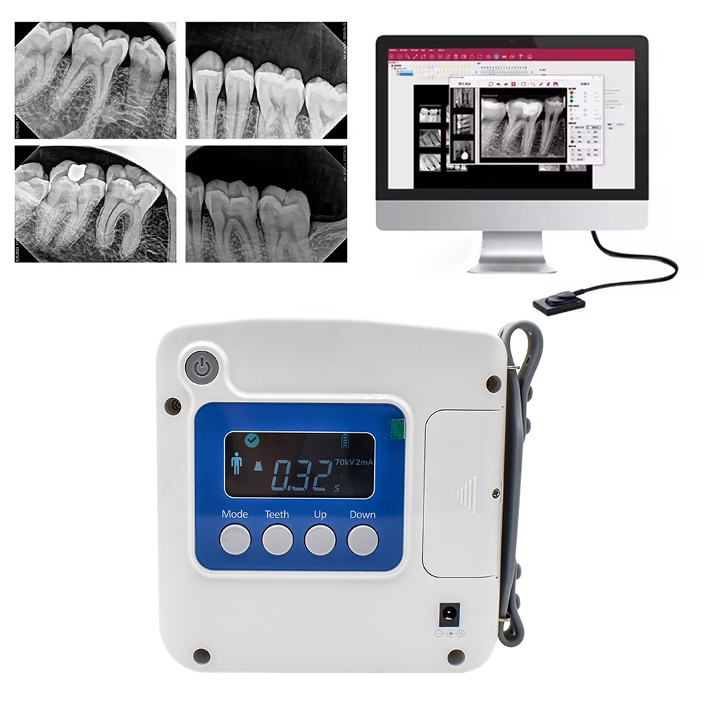 Runyes 70KV 2mA Dental X-Ray Unit ความถี่สูงดิจิตอลแบบพกพาหน้าจอสัมผัสเครื่อง