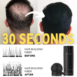 [🇹🇭⚡12hจัดส่ง] 4PCS Toppik Hair Fibers สเปรย์หนาผม Building Fibers Loss ผลิตภัณฑ์ทันทีวิกผม Regrowth ผง