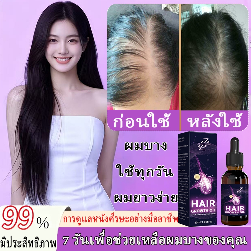 เอสเซ้นส์ปลูกผมอย่างรวดเร็วบอกลาหัวล้านเร่งการเจริญเติบโตของเส้นผมใหม่ซ่อมแซมผมสปาร์กครีมปลูกผมป้องกันผมร่วง ไม่จํากัดเพศ มีผมแช่