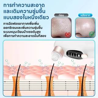 INSMART เครื่องดูดสิว เครื่องดูดสิวเสี้ยน ปรับได้ 3 ระดับ กำจัดสิวหัวดำไฟฟ้า ทำความสะอาดรูขุมขน