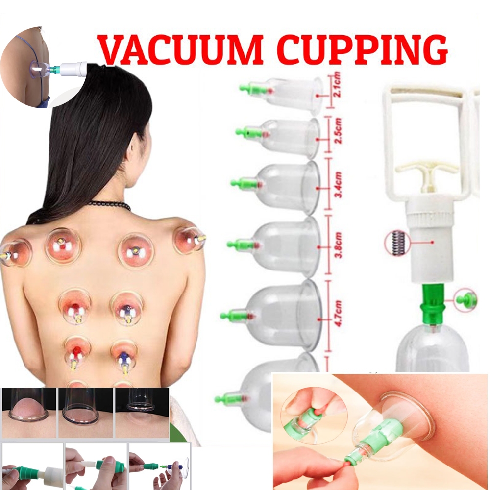 12PCS สูญญากาศ Cupping Therapy ชุด Ventosa Cupping Therapi ชุดกลับนวด Body Cup Detox Anti Cellulite กระป๋อง Healthy Care Jars