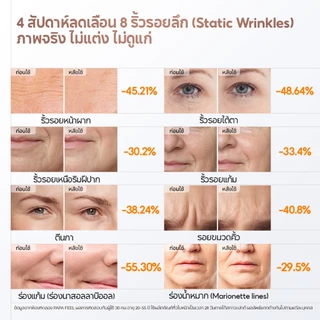 PAPA FEEL Ultra 5A Retinol Anti-Aging กระชับผิว สีผิวสม่ำเสมอ Cream 50g | ช่วยลดเลือนริ้วรอยแห่งวัย | ต้านอนุมูลอิสระ ลดเลือนริ้วรอย | และกระชับรูขุมขน