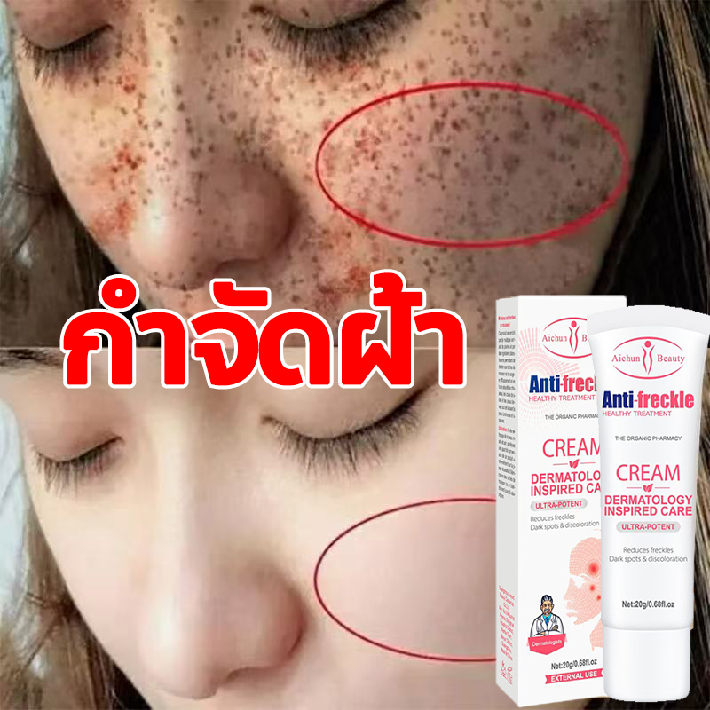 【ยินดีคืนเงินหากไม่เห็นผล】ครีมลดฝ้า กระ จุดด่างดำ ปรับผิวขาวกระจ่างใส