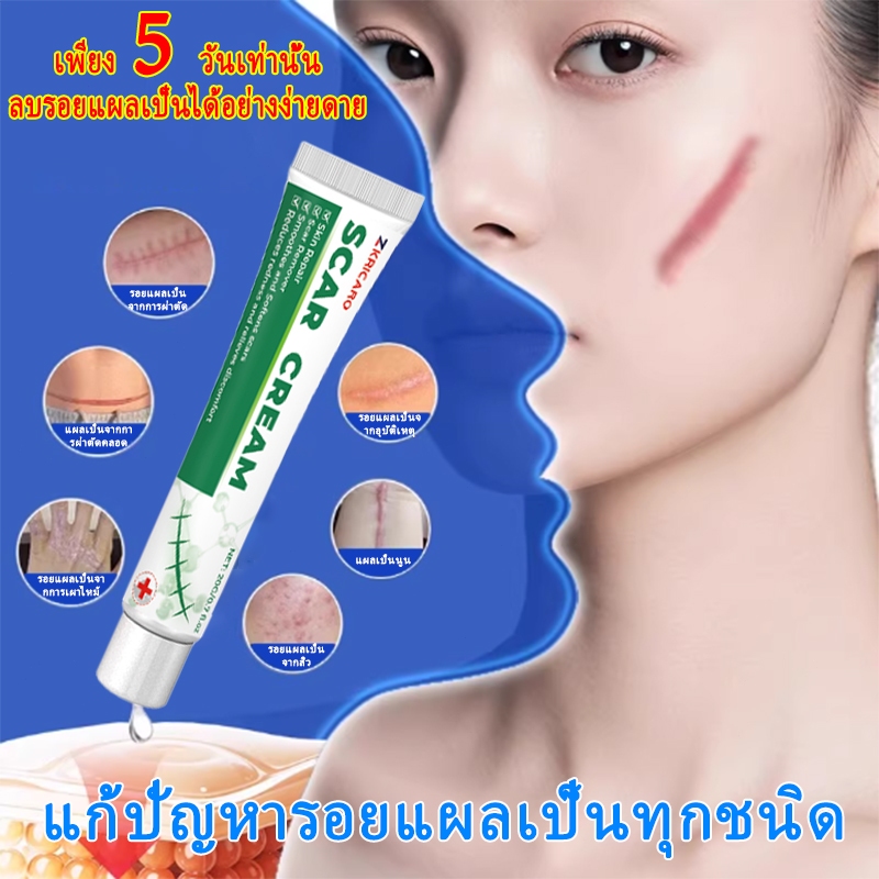 ครีมลดรอยแผลเป็น เร็ว ซ่อมรอยแผลเป็นเสียดสี เบิร์นรอยแผลเป็น จุดกัดแมลงอ่อน รอยแตกลาย คีลอยด์ แผลเป็นไทรอยด์ บอกลาแผลเป็น และเร่งการซ่อมแซมผิ