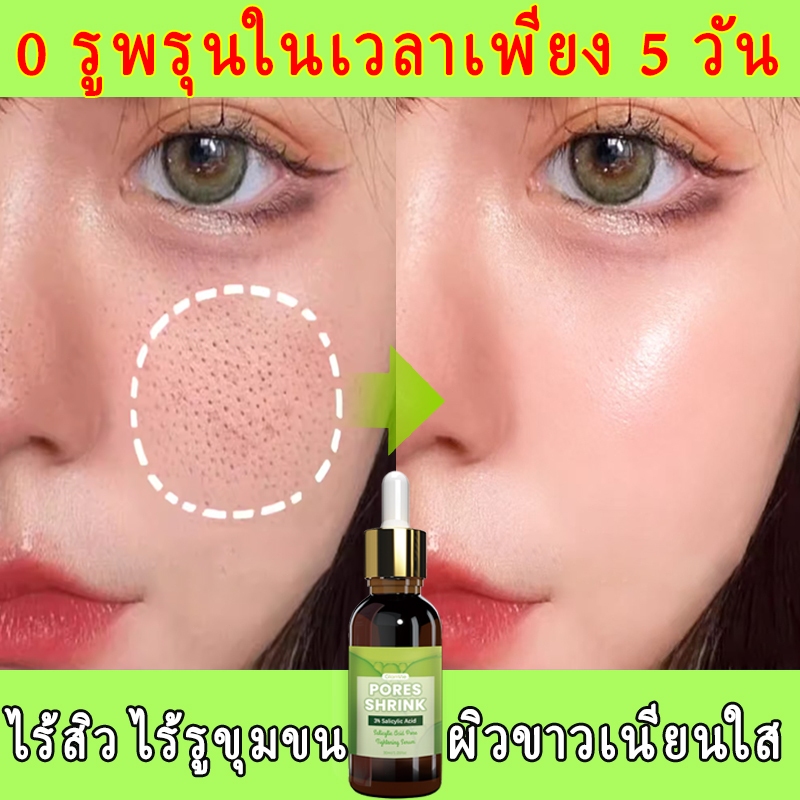 รูขุมขนหดตัวอย่างรวดเร็วทําความสะอาดสาระสําคัญบนใบหน้า, เอสเซ้นส์กระชับ, ให้ความชุ่มชื้นและควบคุมความมัน, สีผิวสว่าง, เอสเซ้นส์สีผิวเอเหน็บ, และทําให้ผ