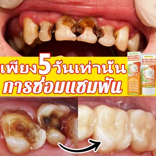 ยาสีฟันป้องกันฟันผุ ผสมฟลูออไรด์ ขจัดคราบ ลมหายใจหอมสดชื่น สูตรอ่อนโยนต่อเหงือก