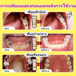 ยาสีฟันป้องกันฟันผุ ผสมฟลูออไรด์ ขจัดคราบ ลมหายใจหอมสดชื่น สูตรอ่อนโยนต่อเหงือก