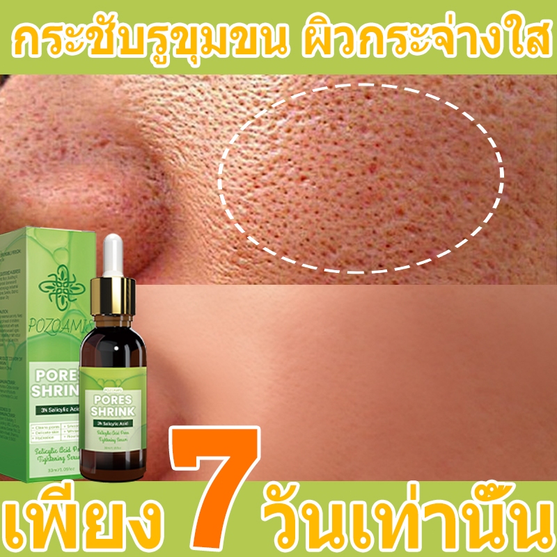 🚀นำเข้าจากเกาหลี🚀เอสเซนส์กระชับรูขุมขน กระชับรูขุมขน ขจัดสิวหัวดำ ลดเลือนรอยสิวและริ้วรอย มอบความชุ่มชื้น กระชับรูขุมขน และยกกระชับผิว เหมาะสำหรับผิวแพ้ง่าย
