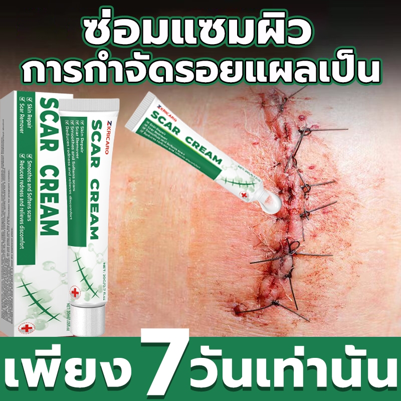 มีผลภายใน 7 วัน ครีมลบรอยแผลเป็น เจลลบรอยแผลเป็น ลดรอยแผลเป็น ลดนูน ลดสิว ใช้สะดวก เหมาะสำหรับผู้ที่ต้องการฟื้นฟูผิว