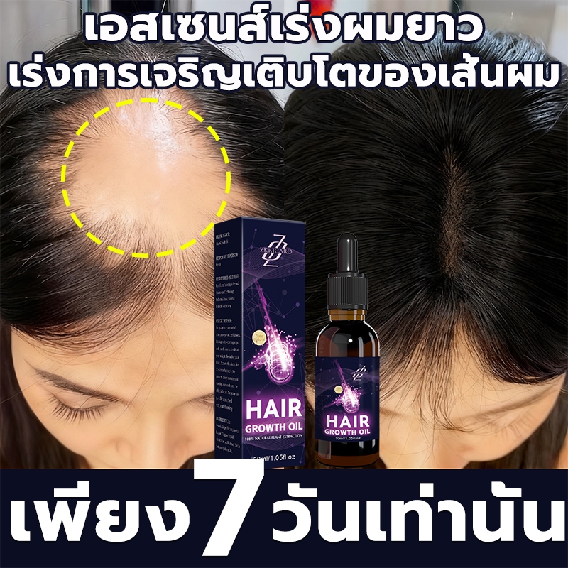 【ได้ผล 100%】เซรั่มเร่งผมยาว กระตุ้นการเจริญเติบโตของเส้นผม กระตุ้นการเกิดผมใหม่ ป้องกันผมร่วง ฟื้นฟูผมหนา ผมยาวเร็ว บำรุงผมหนา