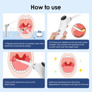มองเห็นไฟฟ้า Tonsil Stone Remover เครื่องมือที่มองเห็นได้ Tonsil Stone Removal Kit 3 โหมดการดูด Tonsil Stone Removal Oral Care