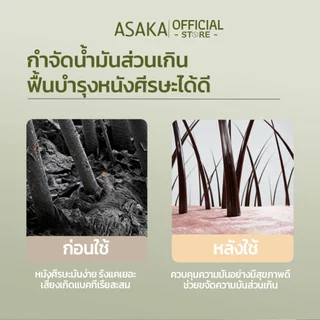 ASAKA anti dandruff hair shampoo แชมพูขจัดรังแค ขจัด รังแค และ อาการ คัน ผมสลวย ขจัดรังแค กลิ่น