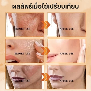 SADOER 5X Antioxidant Vitamin C Brightening Serum Toner เซรั่มวิตามินซีผสมสด เพื่อผิวใส จุดด่างดำแลดูจางลง