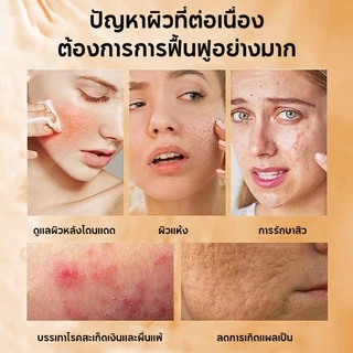SADOER 5X Antioxidant Vitamin C Brightening Serum Toner เซรั่มวิตามินซีผสมสด เพื่อผิวใส จุดด่างดำแลดูจางลง