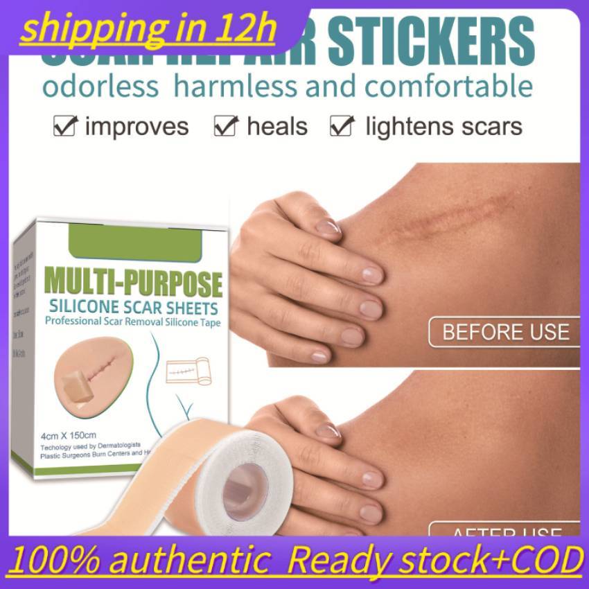 จัดส่งใน 12ชม. ซิลิโคนเจลแถบแพทช์ซิลิโคนแผลเป็นแผ่นนํามาใช้ใหม่ซิลิโคนแผลเป็นกําจัดแพทช์ลบ ทูมา เผาแผลเป็นแผ่นซ่อมแซมผิวกําจัดรอยแผลเป็นแพทช์บําบัด