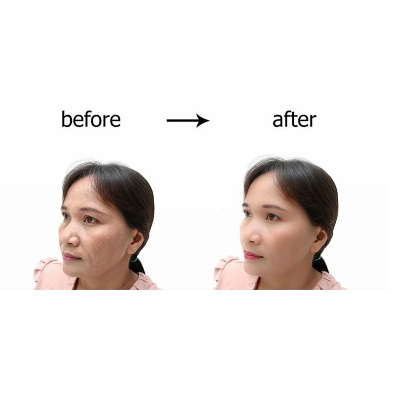 Profhilo 5 point face lift Approval Essence ให้ความชุ่มชื้น ปรับผิวกระจ่างใส Lift Face Shape 2ml ราคา ถูกที่สุด ดีลบีเคเค แกลเลอรีภาพที่ 6