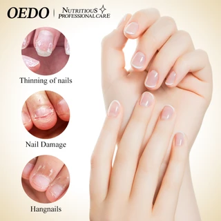 OEDO รักษาเชื้อราเล็บขบ ยาทาฆ่าเชื้อราที่เล็บ