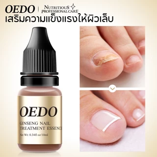 OEDO รักษาเชื้อราเล็บขบ ยาทาฆ่าเชื้อราที่เล็บ