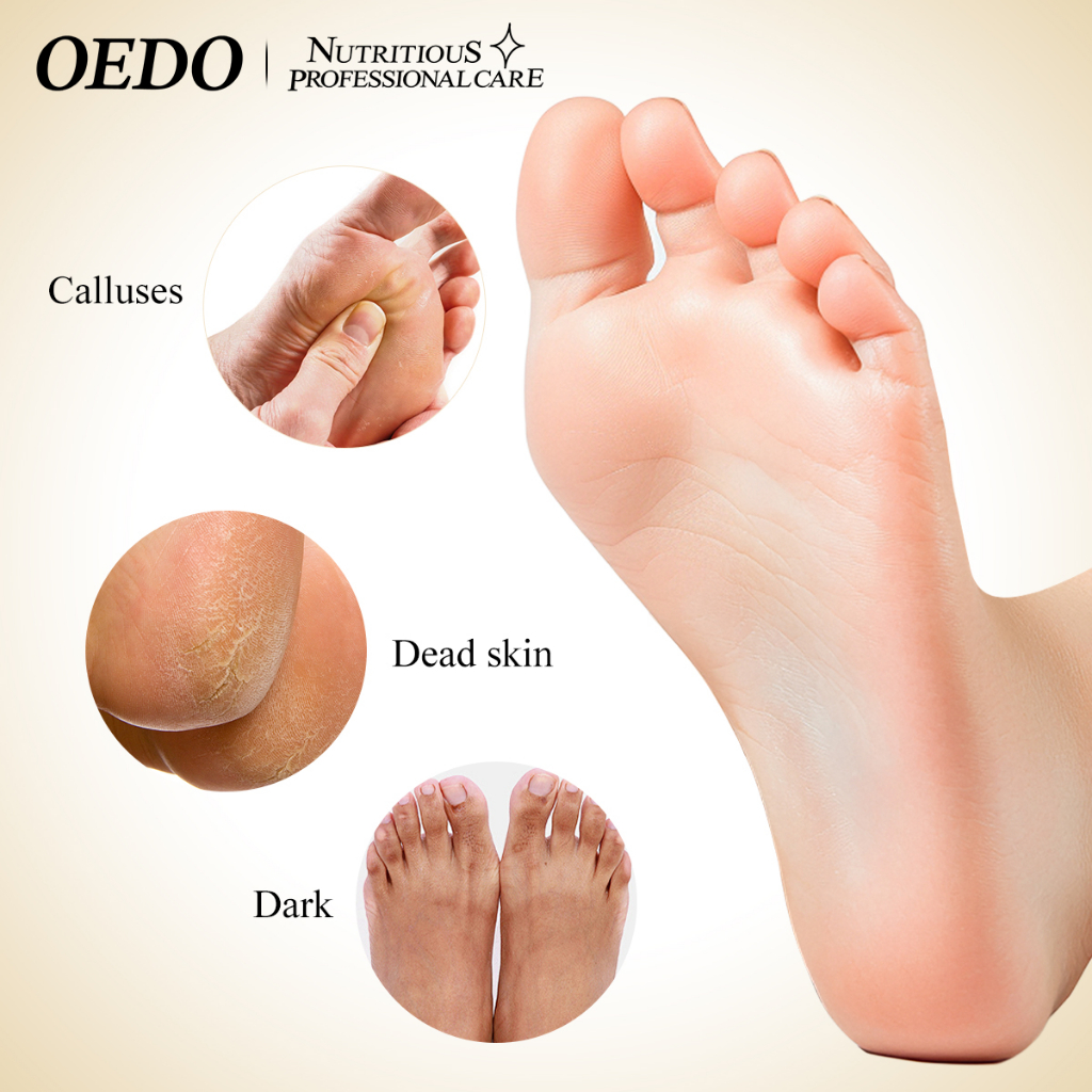 OEDO FDA มาส์กขัดผิวเท้า ลอกออกมาส์กเท้า ขจัดผิวที่ตายแล้วรอบเท้า ค่อยๆลอกเท้าแคลลัสออก แผ่นมาสก์เท้า ขจัดเซลล์ผิวที่ตายเเล้ว Foot Peel Mask 1 ซอง - รูปที่ 6