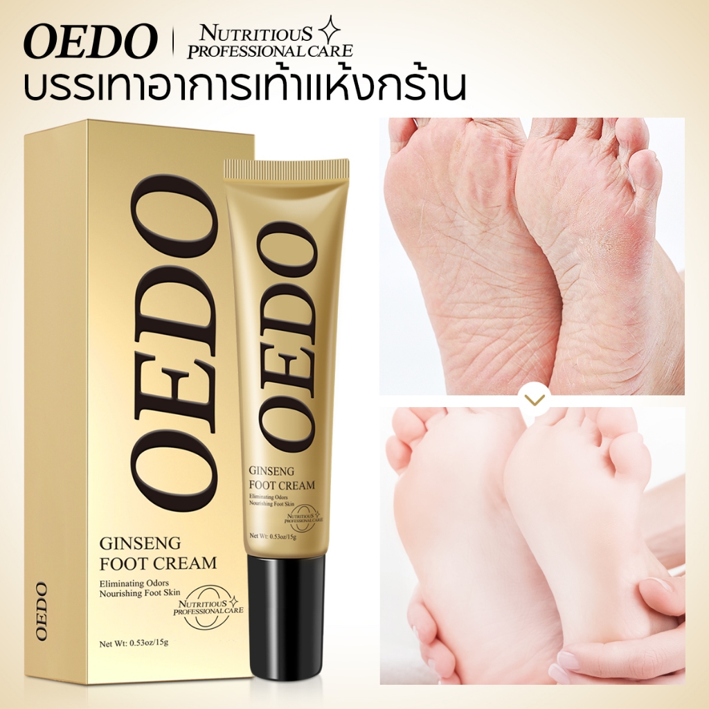OEDO โสมเล็บ ครีมบํารุงเล็บป้องกันการเชื้อราสําหรับดูแลเล็บเท้า ครีมบำรุงเท้า 15กรัม