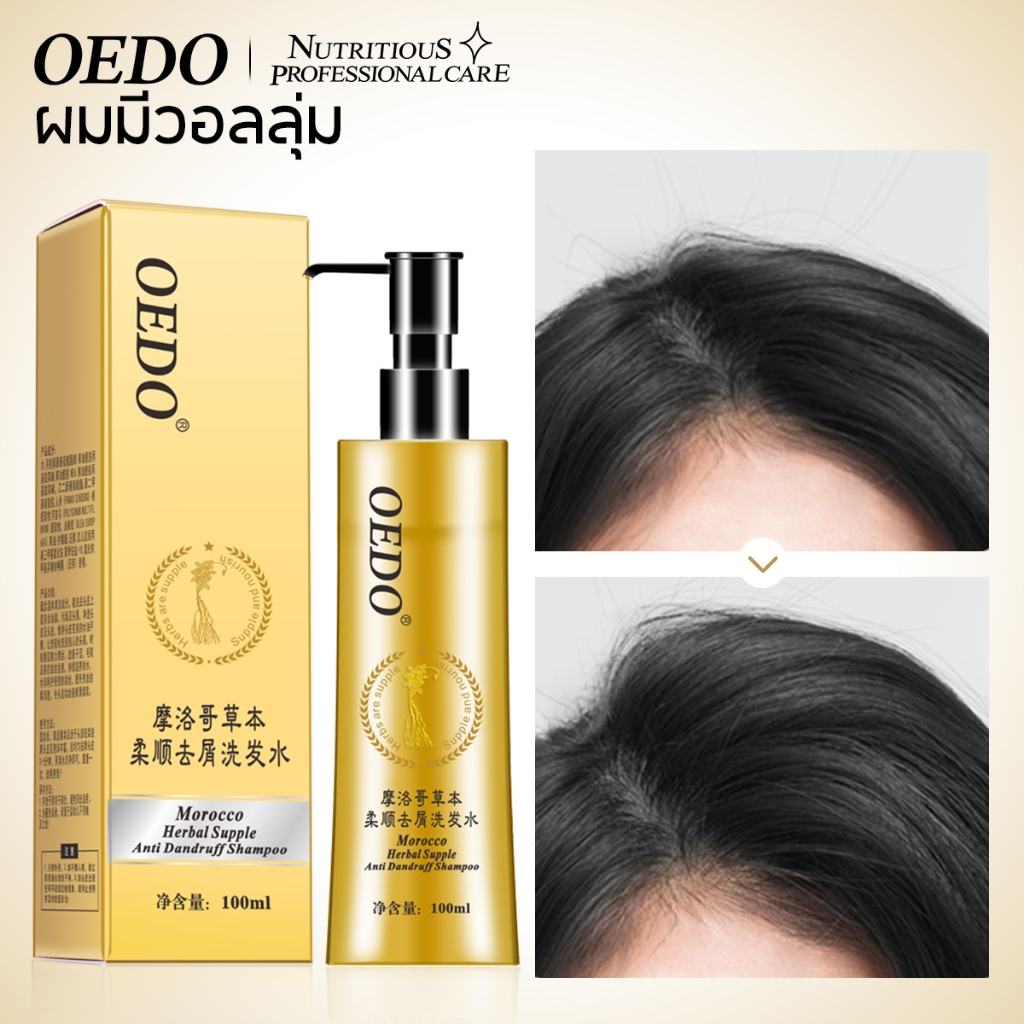 OEDO Morocco แชมพูทําความสะอาดหนังศีรษะ ป้องกันรังแค ขนาด 100 มล.