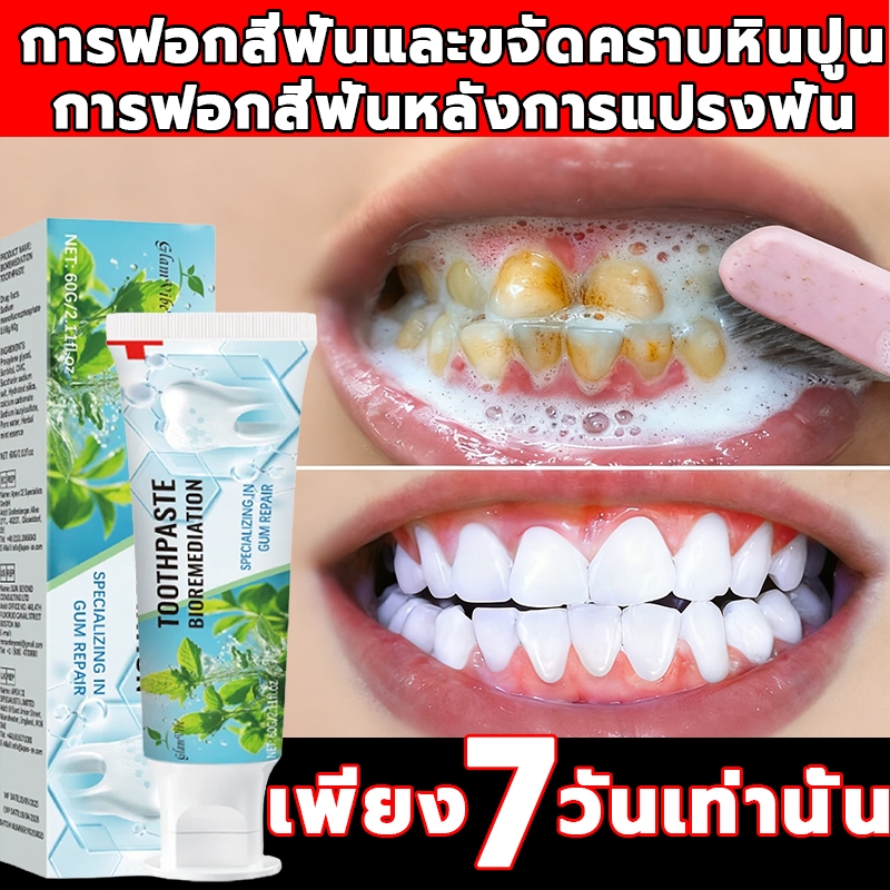 นำเข้าจากญี่ปุ่น ยาสีฟันไวท์เทนนิ่ง ขจัดคราบกาแฟ ฟันเหลือง กลิ่นปาก 60g