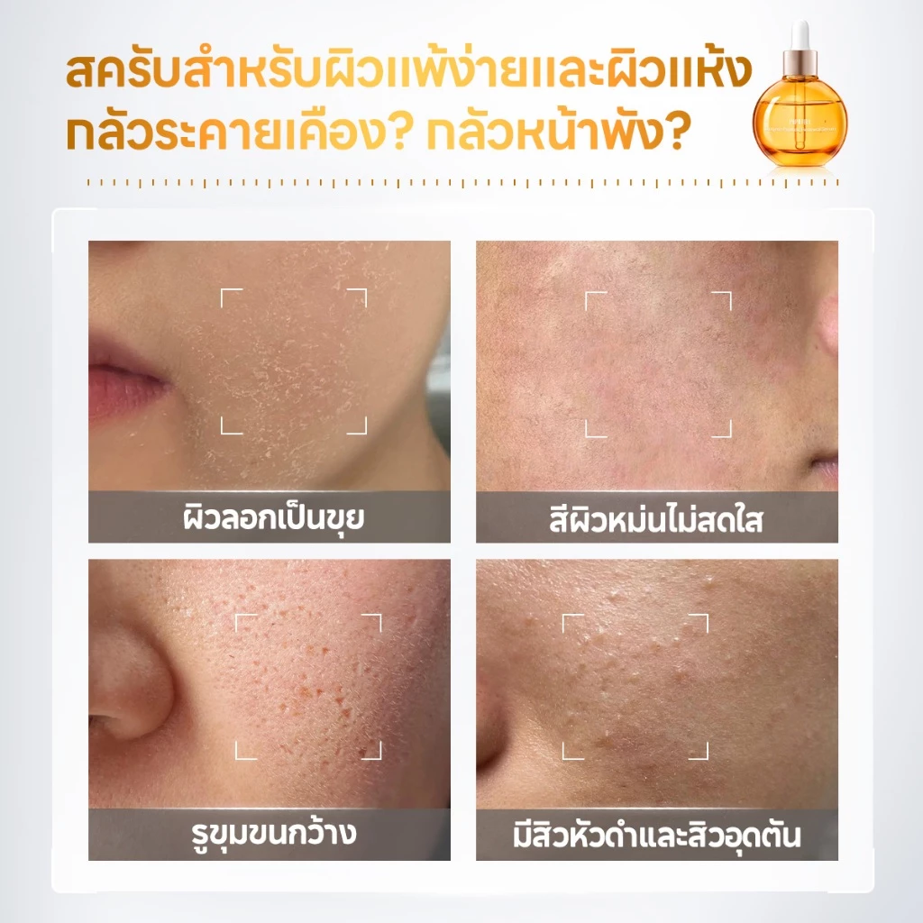 PAPA FEEL 0 Acid Peeling Serum PAPAIN BROMELAIN 8D Hyaluronic Acid 30ml thumbnail 4